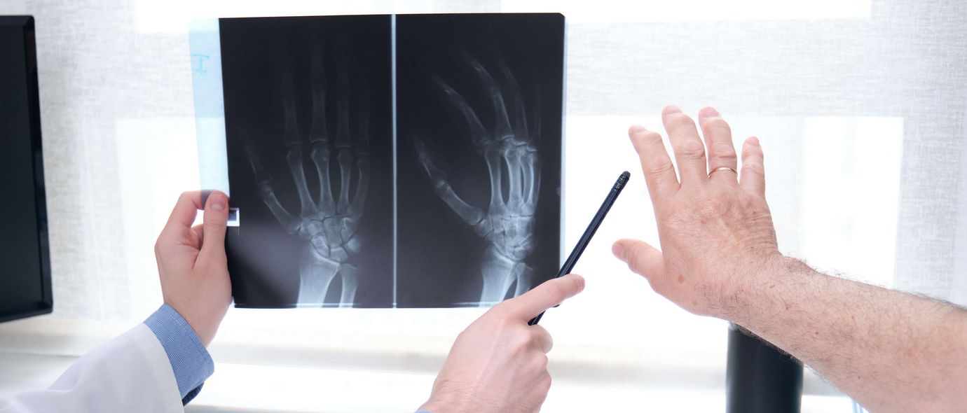 Arzt erklärt Patienten Röntgenbild einer Hand auf dem Computermonitor